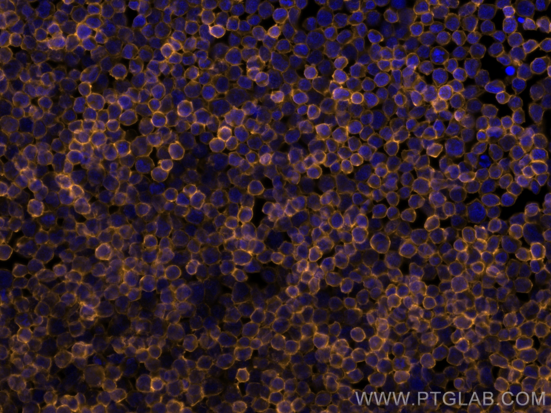 Immunofluorescence (IF) / fluorescent staining of Jurkat cells using FcZero-rAb™ PE Anti-Human CD45 Rabbit Recombinant  (PE-FcA98117)