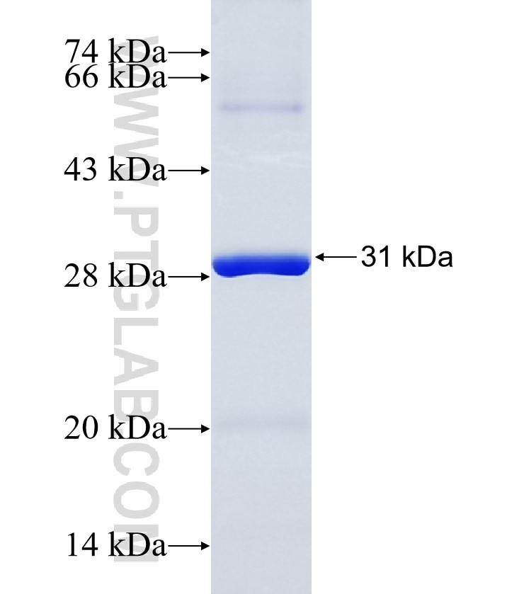 CD45 fusion protein Ag28540 SDS-PAGE