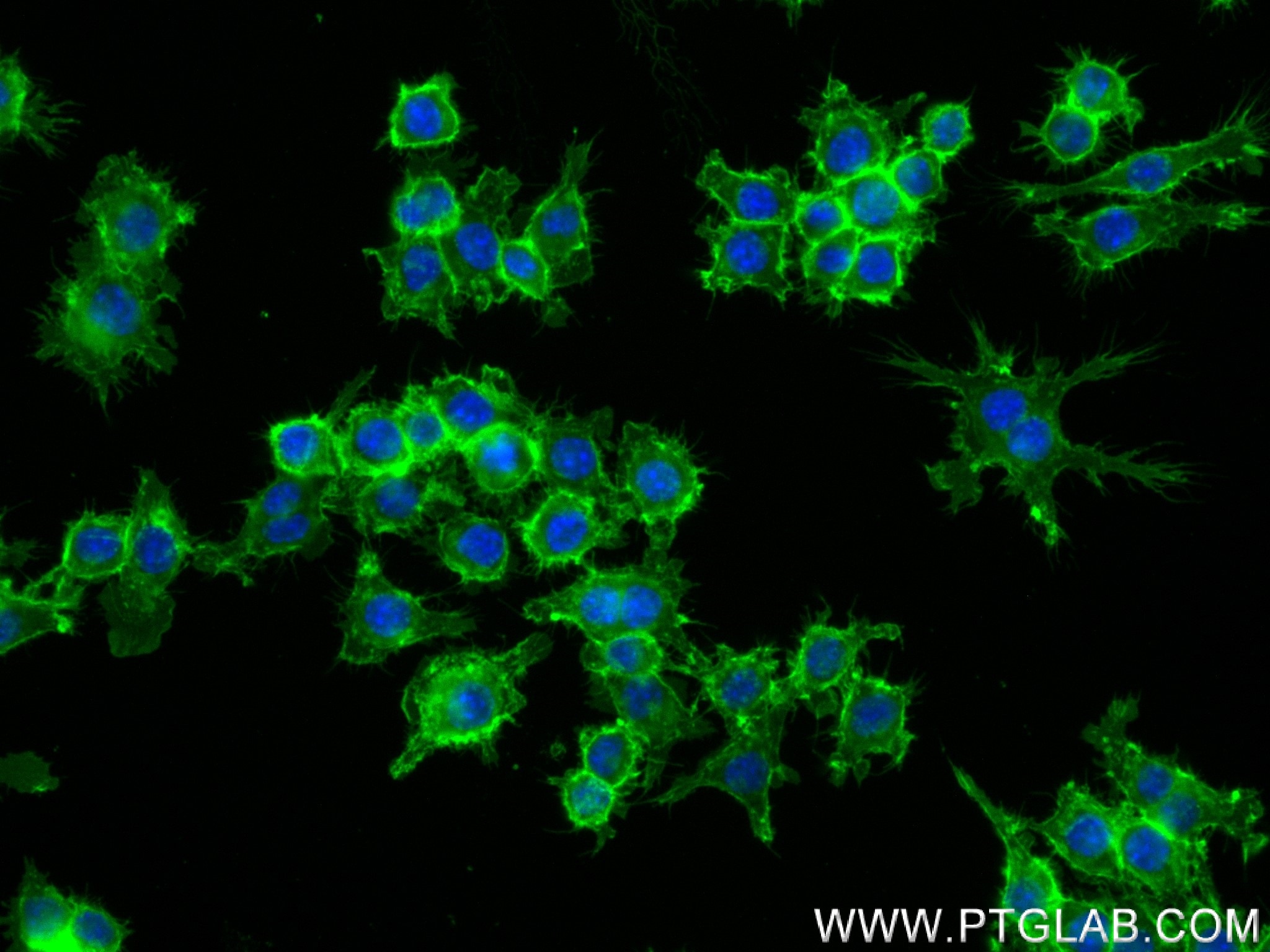 Immunofluorescence (IF) / fluorescent staining of RAW 264.7 cells using CD45 Recombinant antibody (83396-12-RR)