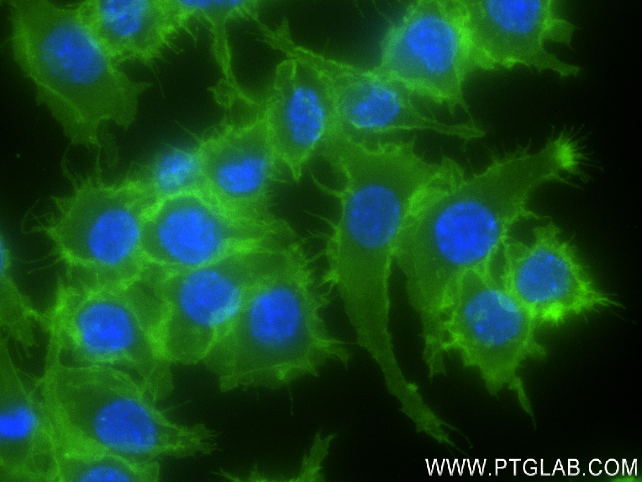 Immunofluorescence (IF) / fluorescent staining of RAW 264.7 cells using CD45 Recombinant antibody (83396-13-RR)