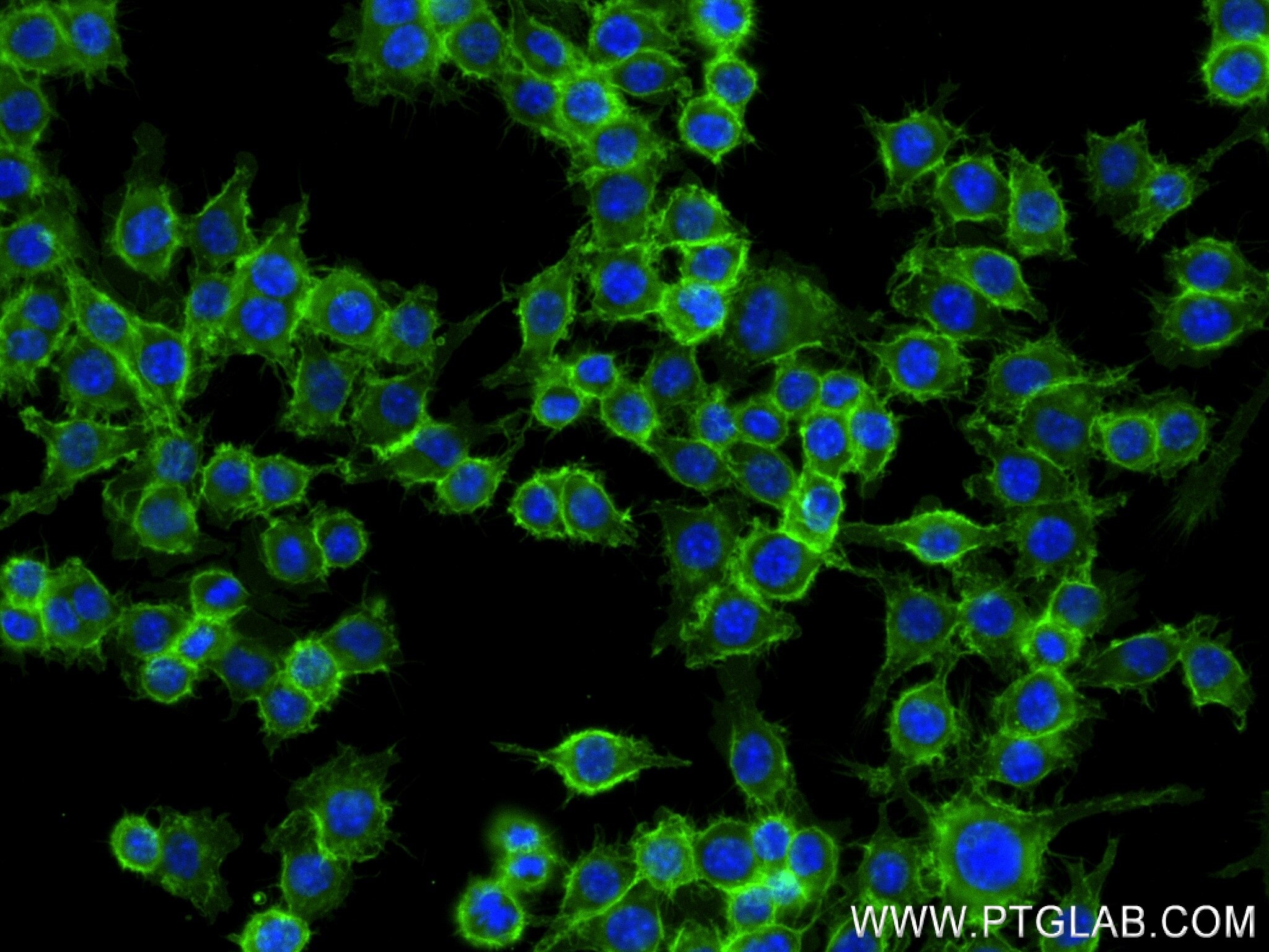 Immunofluorescence (IF) / fluorescent staining of RAW 264.7 cells using CD45 Recombinant antibody (83396-13-RR)
