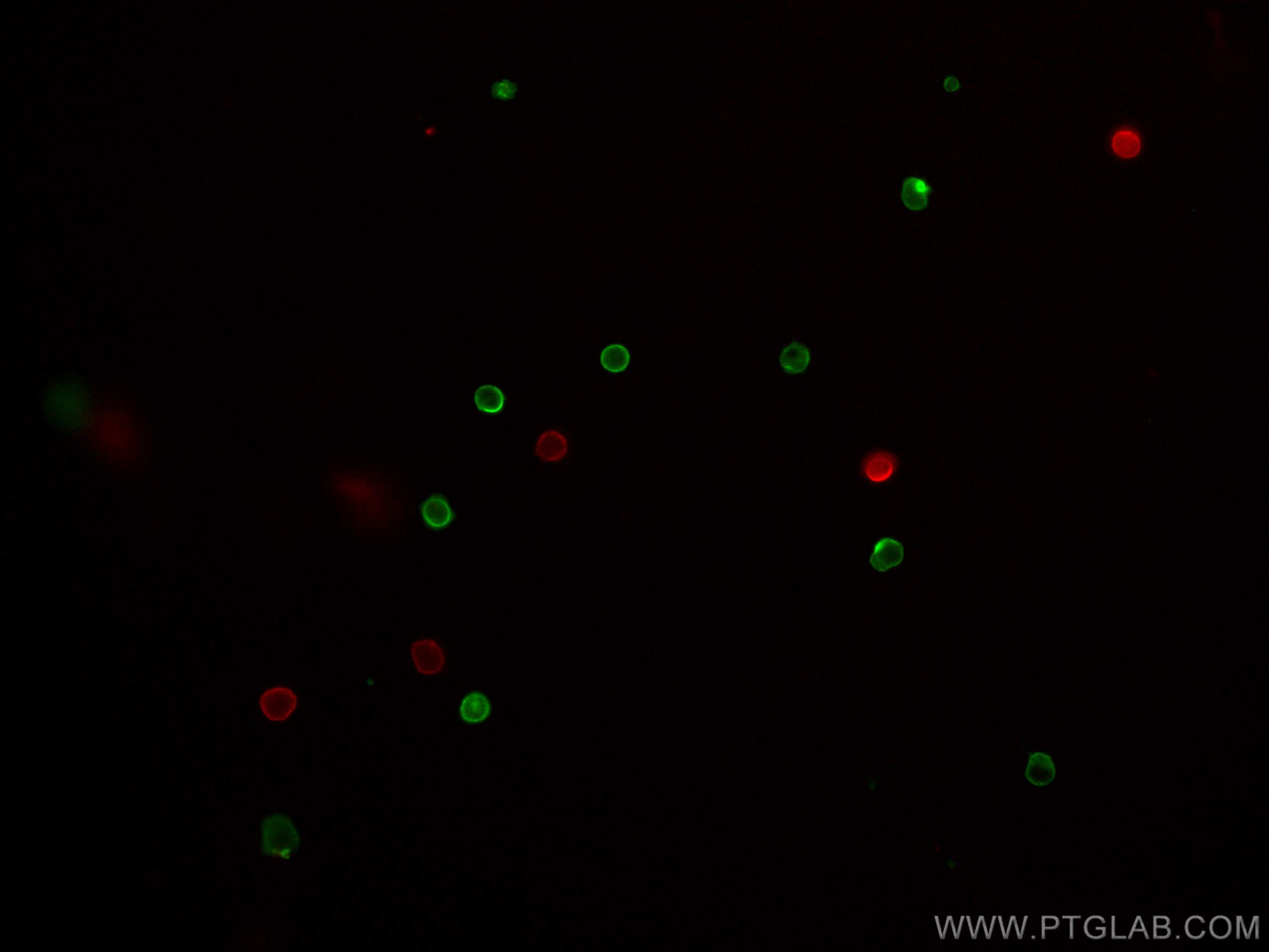 Immunofluorescence (IF) / fluorescent staining of mouse splenocytes using CoraLite® Plus 488 Anti-Mouse CD45R (B220) (RA3-6B (CL488-65139)