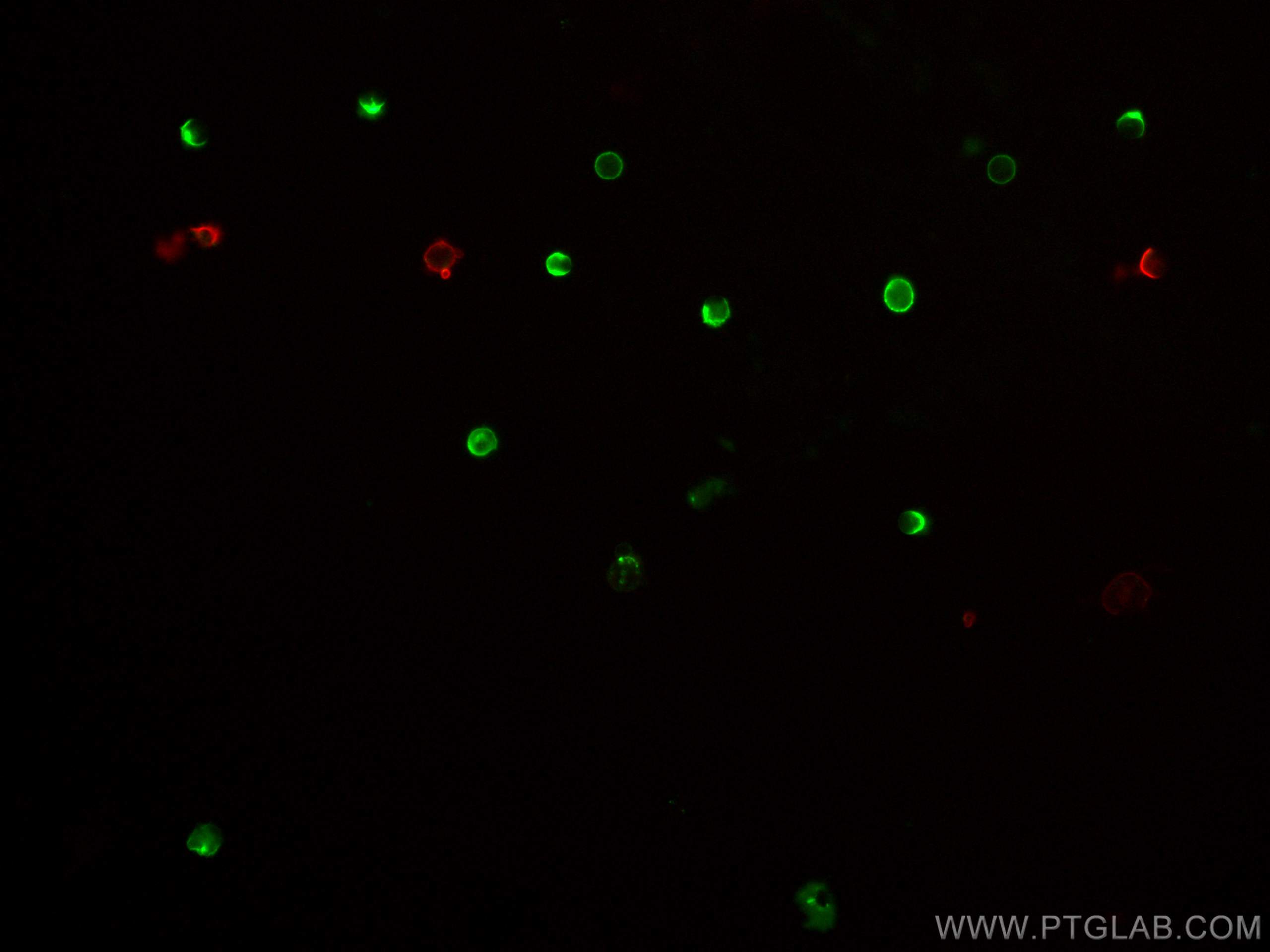 Immunofluorescence (IF) / fluorescent staining of mouse splenocytes using CoraLite® Plus 647 Anti-Mouse CD45R (B220) (RA3-6B (CL647-65139)