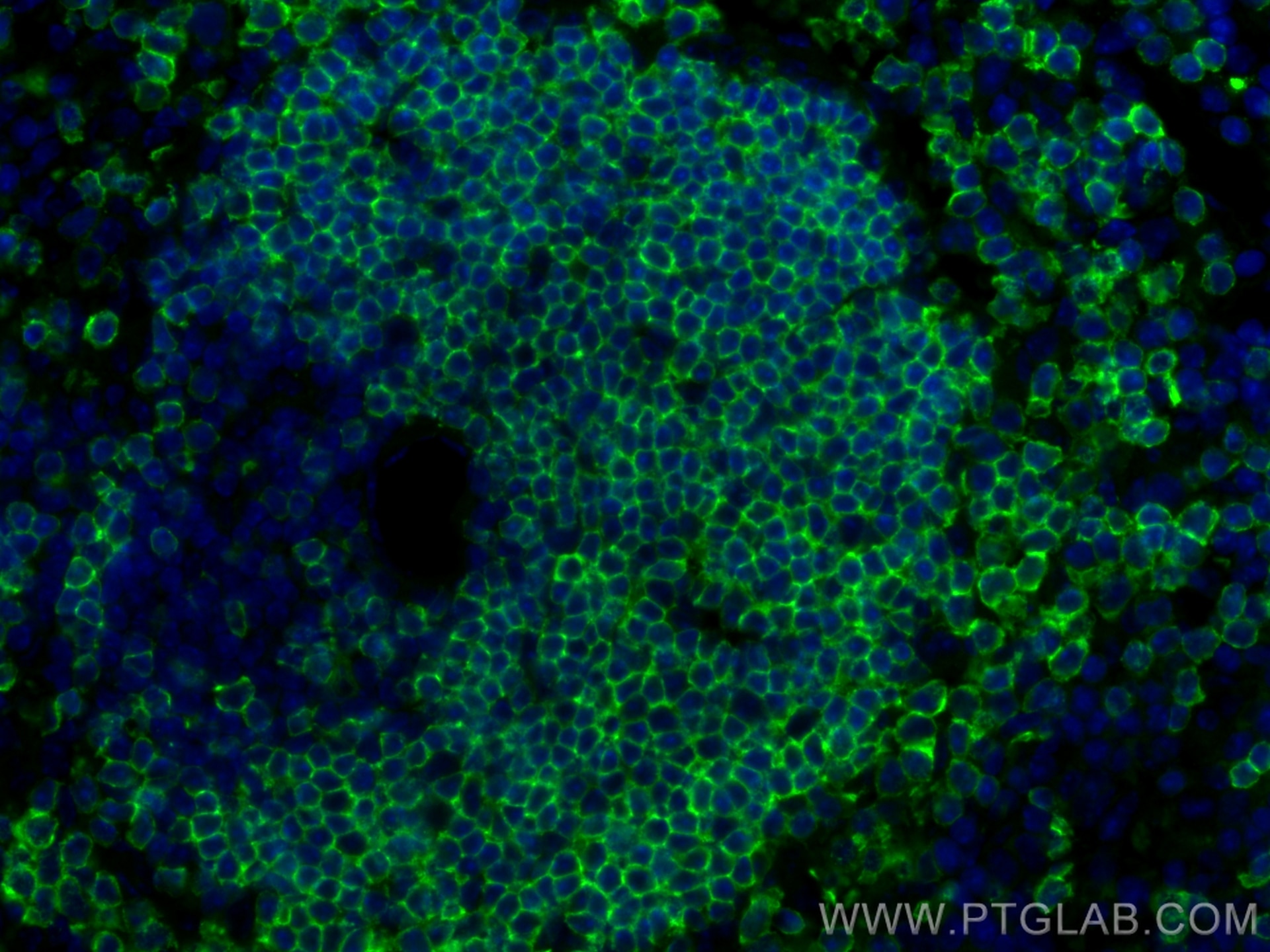 Immunofluorescence (IF) / fluorescent staining of mouse spleen tissue using Anti-Mouse CD45R (B220) (RA3-6B2) (65139-1-Ig)
