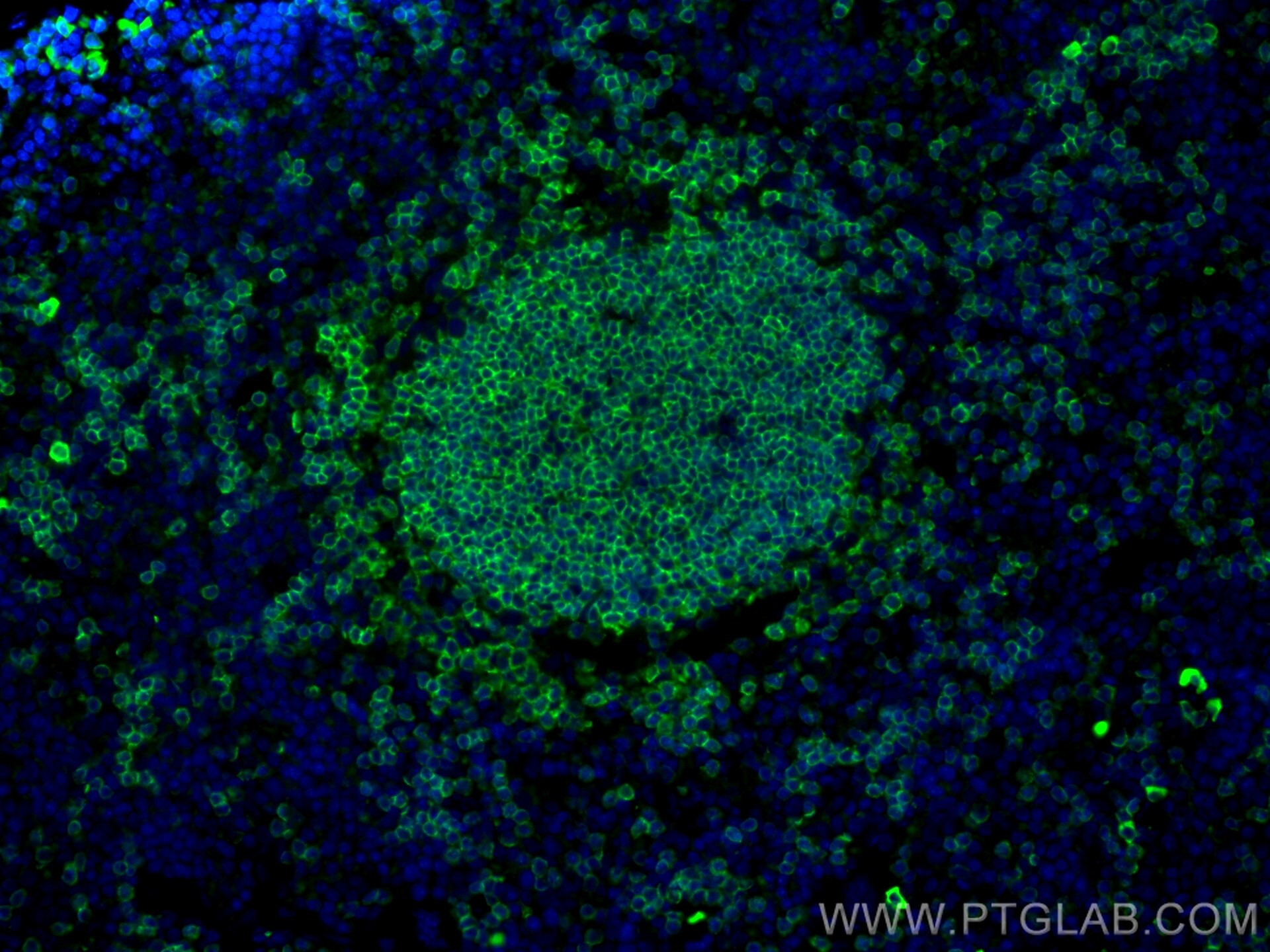 Immunofluorescence (IF) / fluorescent staining of mouse spleen tissue using Anti-Mouse CD45R (B220) (RA3-6B2) (65139-1-Ig)