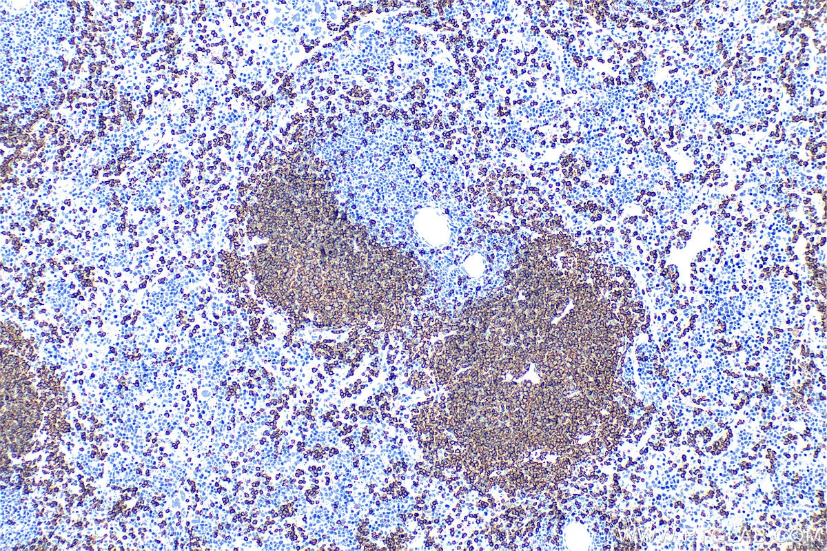 Immunohistochemistry (IHC) staining of mouse spleen tissue using Anti-Mouse CD45R (B220) (RA3-6B2) (65139-1-Ig)