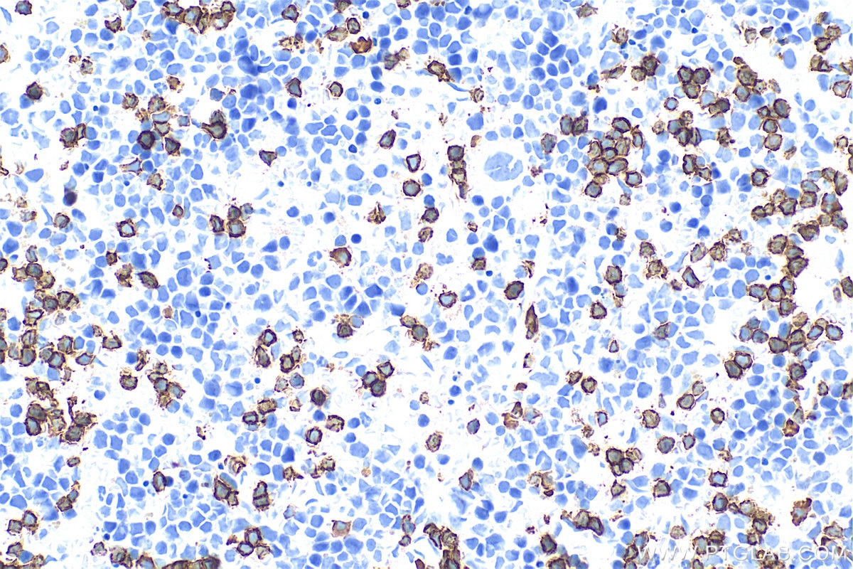 Immunohistochemistry (IHC) staining of mouse spleen tissue using Anti-Mouse CD45R (B220) (RA3-6B2) (65139-1-Ig)