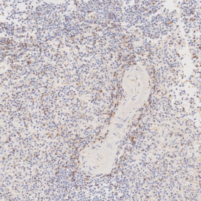 Immunohistochemistry (IHC) staining of human spleen tissue using Anti-Human CD45RO (UCHL1) (65150-1-Ig)