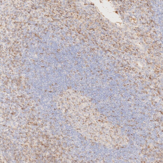 Immunohistochemistry (IHC) staining of human appendicitis tissue using Anti-Human CD45RO (UCHL1) (65150-1-Ig)