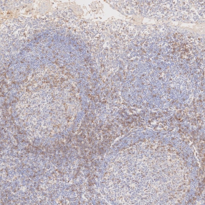Immunohistochemistry (IHC) staining of human tonsillitis tissue using Anti-Human CD45RO (UCHL1) (65150-1-Ig)