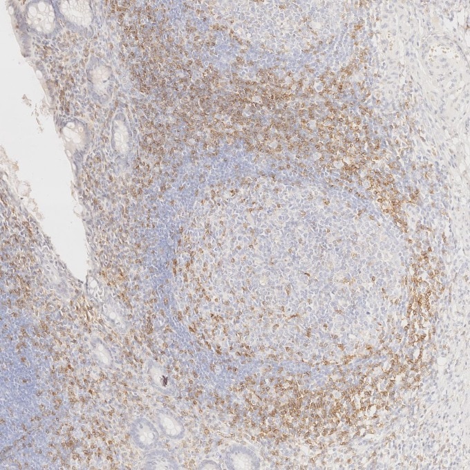 Immunohistochemistry (IHC) staining of human appendicitis tissue using Anti-Human CD45RO (UCHL1) (65150-1-Ig)