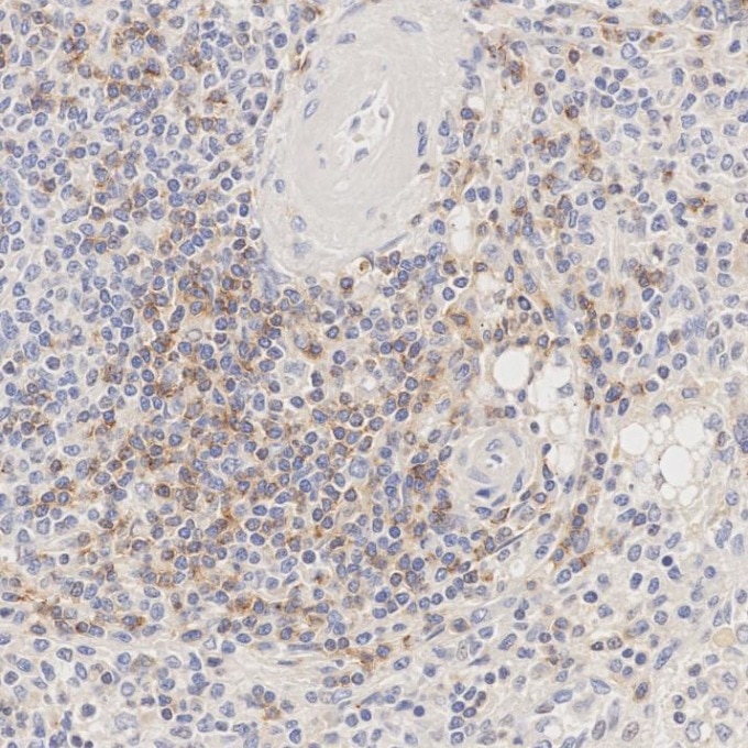 Immunohistochemistry (IHC) staining of human spleen tissue using Anti-Human CD45RO (UCHL1) (65150-1-Ig)