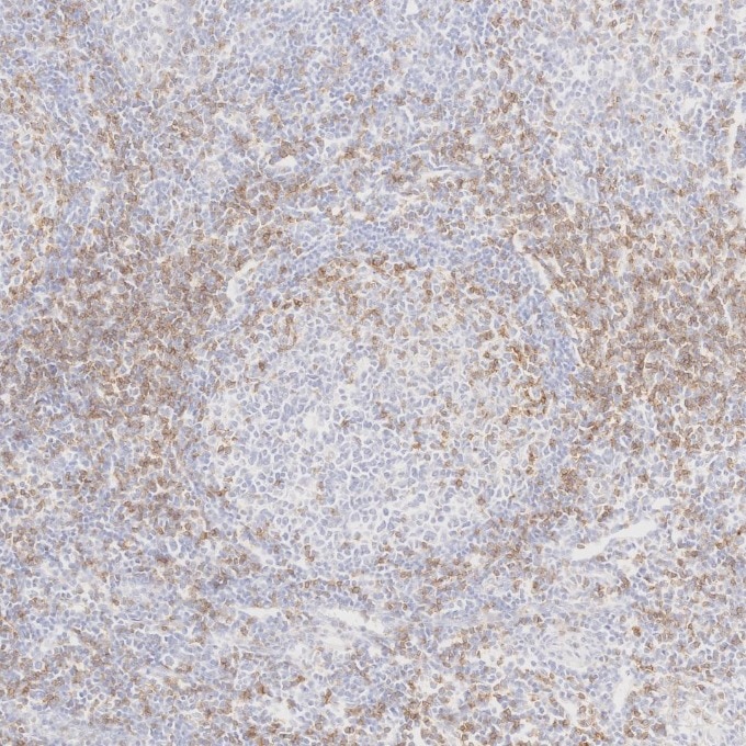 Immunohistochemistry (IHC) staining of human tonsillitis tissue using Anti-Human CD45RO (UCHL1) (65150-1-Ig)
