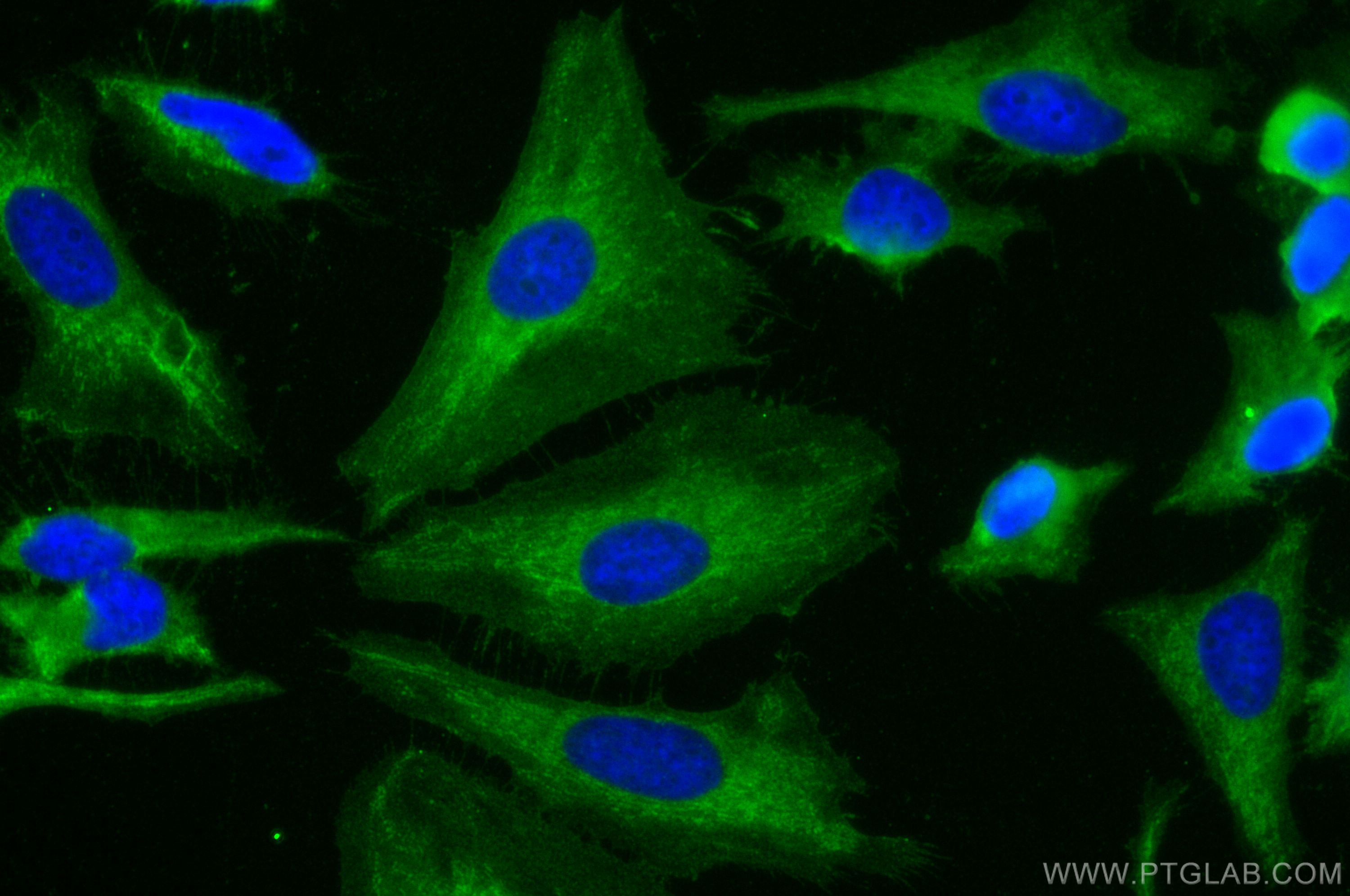 Immunofluorescence (IF) / fluorescent staining of HeLa cells using CD46 Polyclonal antibody (12494-1-AP)