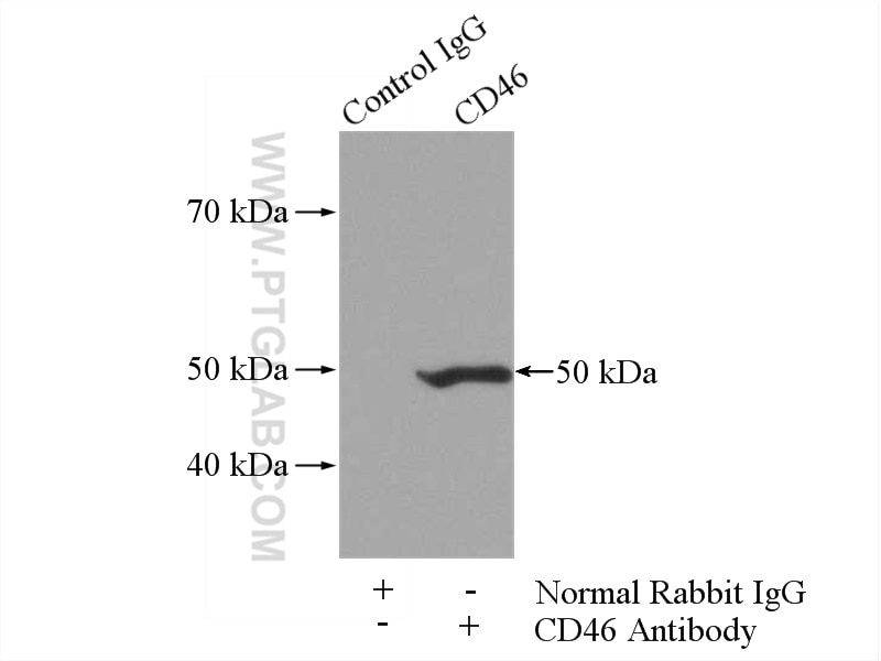 Immunoprecipitation (IP) experiment of A549 cells using CD46 Polyclonal antibody (12494-1-AP)