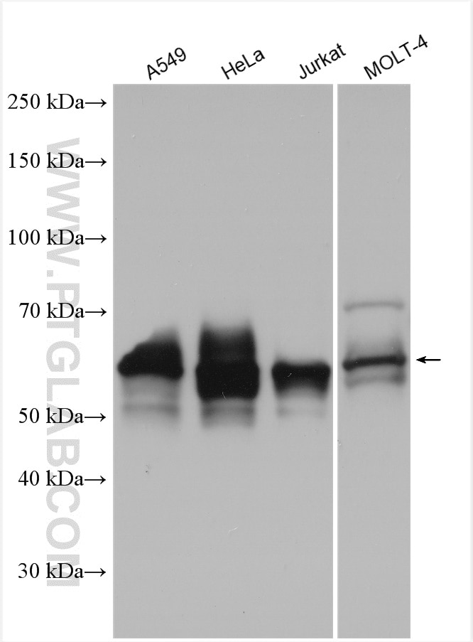 Western Blot (WB) analysis of various lysates using CD46 Polyclonal antibody (12494-1-AP)