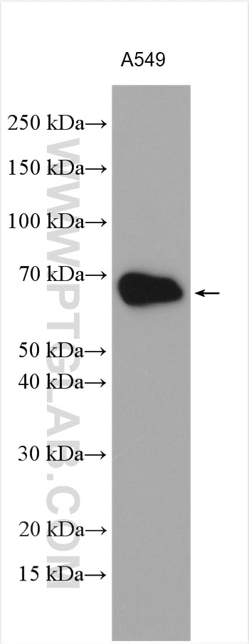 Western Blot (WB) analysis of various lysates using CD46 Polyclonal antibody (28936-1-AP)