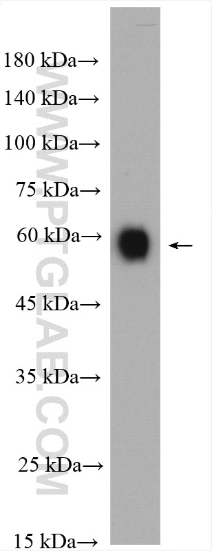 Western Blot (WB) analysis of Jurkat cells using CD46 Polyclonal antibody (28936-1-AP)