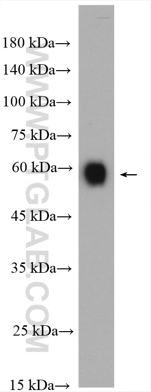 WB analysis of Jurkat using 28936-1-AP