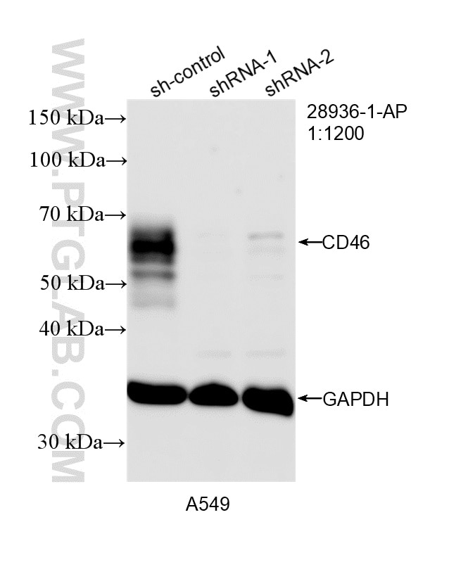 WB analysis of A549 using 28936-1-AP Western Blot (WB) analysis of A549 cells using CD46 Polyclonal antibody (28936-1-AP)