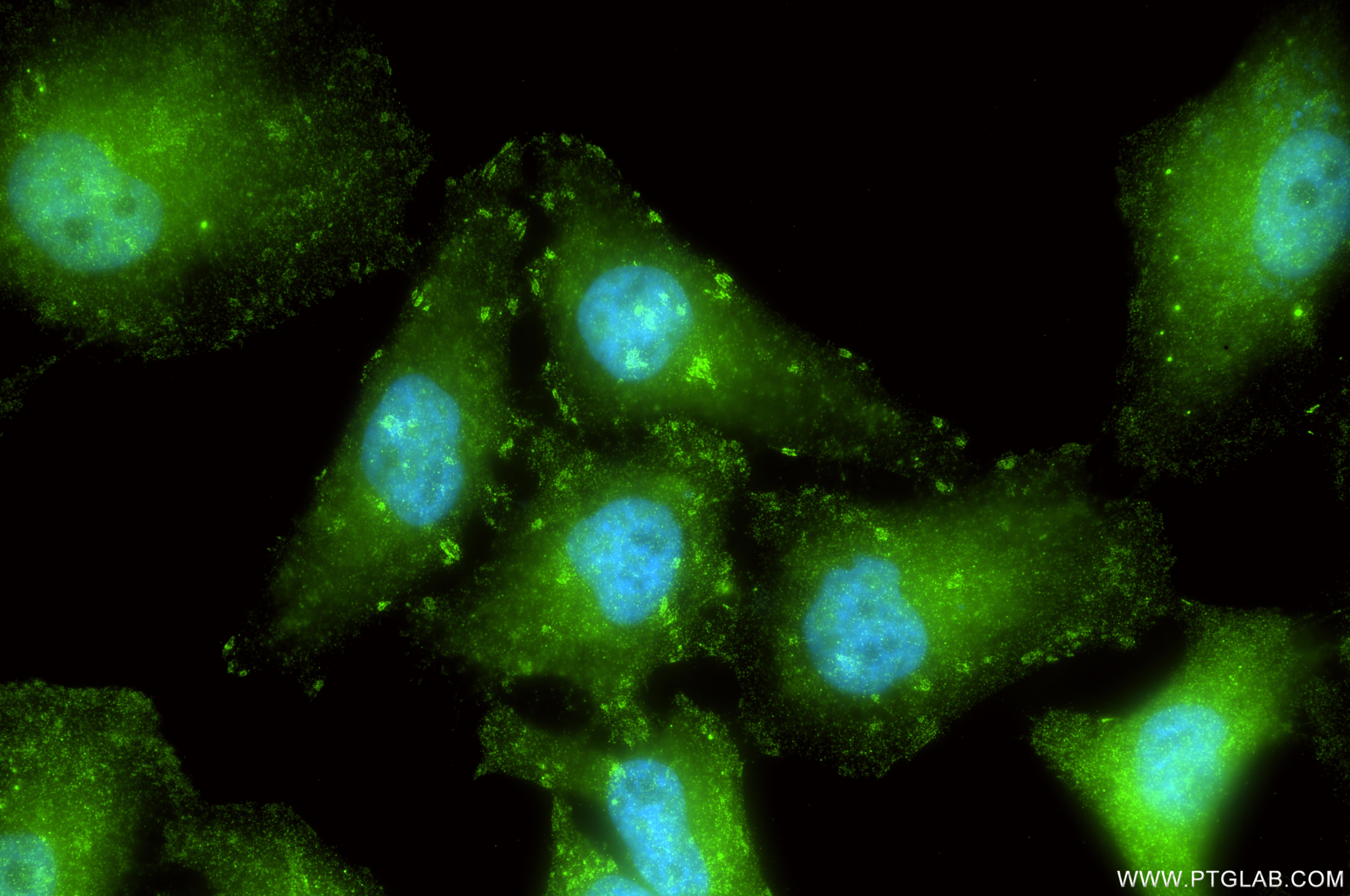 Immunofluorescent analysis of (4% PFA) fixed HeLa cells using CD46 antibody (98240-1-RR, Clone: 241764C9 ) at dilution of 1:500 and CoraLite®488-Conjugated Goat Anti-Rabbit IgG(H+L) (SA00013-2). Immunofluorescence (IF) / fluorescent staining of HeLa cells using Anti-Human CD46 Rabbit Recombinant Antibody (98240-1-RR)