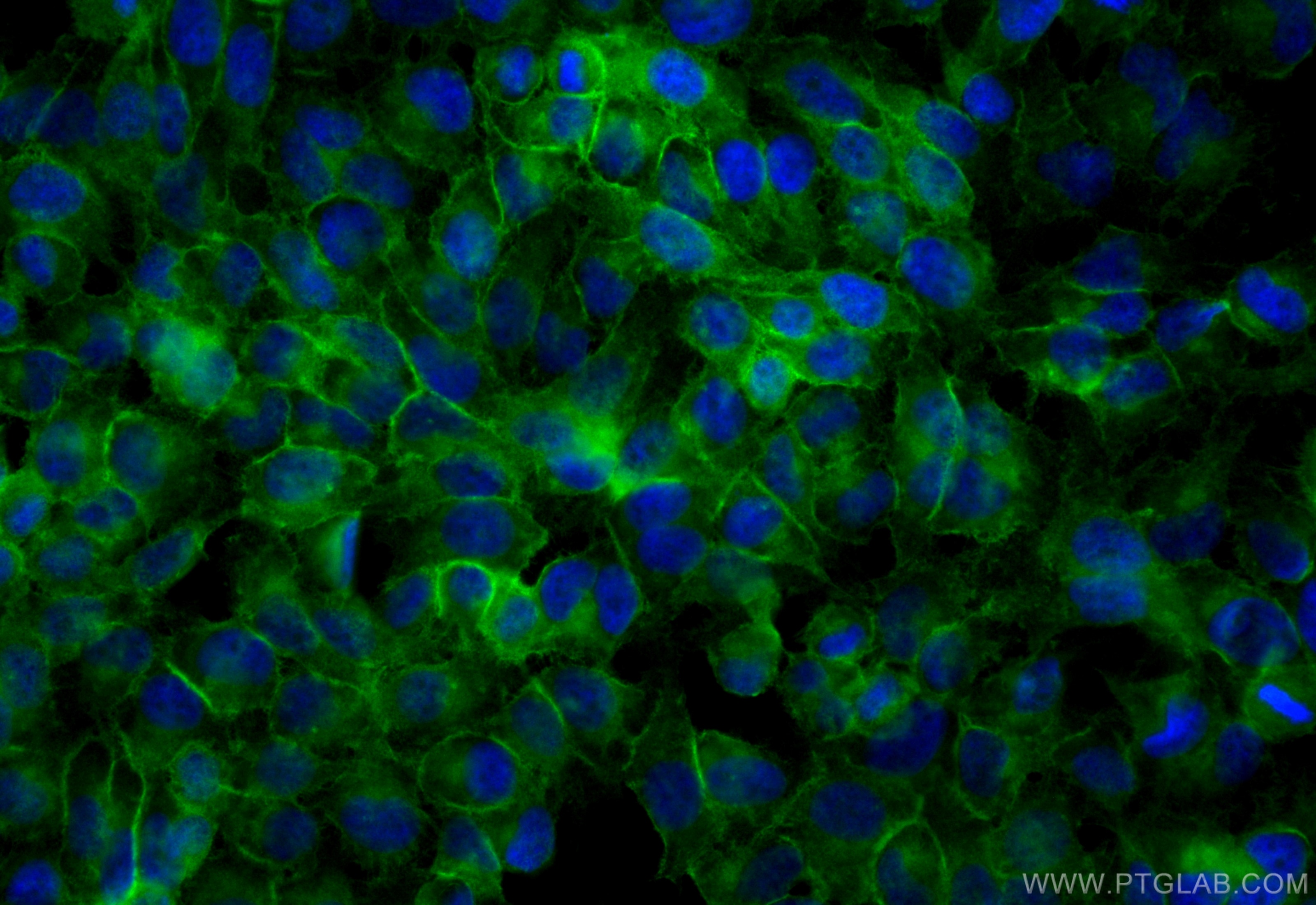 Immunofluorescence (IF) / fluorescent staining of HeLa cells using CoraLite® Plus 488-conjugated CD46 Recombinant ant (CL488-84599-5)