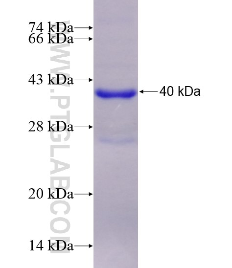 CD46 fusion protein Ag28581 SDS-PAGE