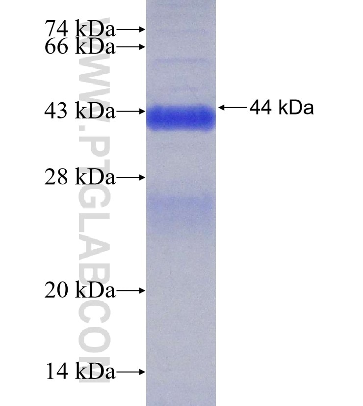CD46 fusion protein Ag30376 SDS-PAGE