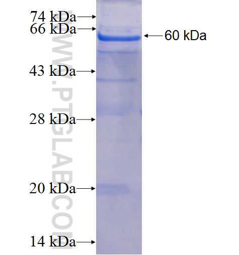 CD46 fusion protein Ag3131 SDS-PAGE