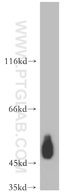 CD47 Polyclonal antibody