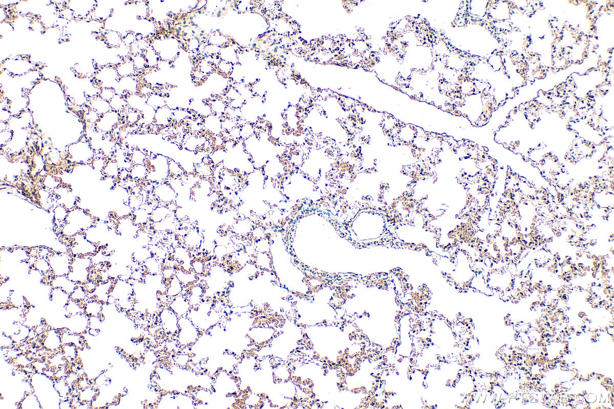 Immunohistochemistry (IHC) staining of mouse lung tissue using CD47 Polyclonal antibody (31886-1-AP)