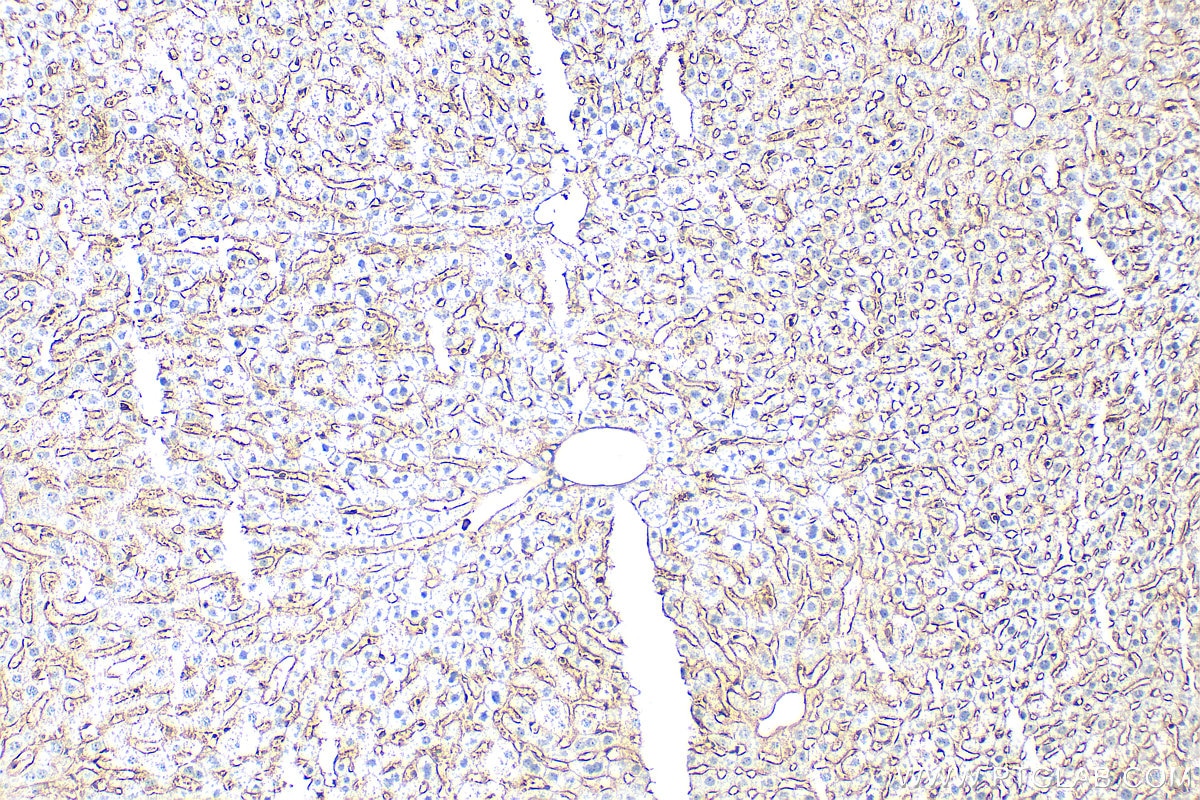 Immunohistochemistry (IHC) staining of mouse liver tissue using CD47 Polyclonal antibody (31886-1-AP)