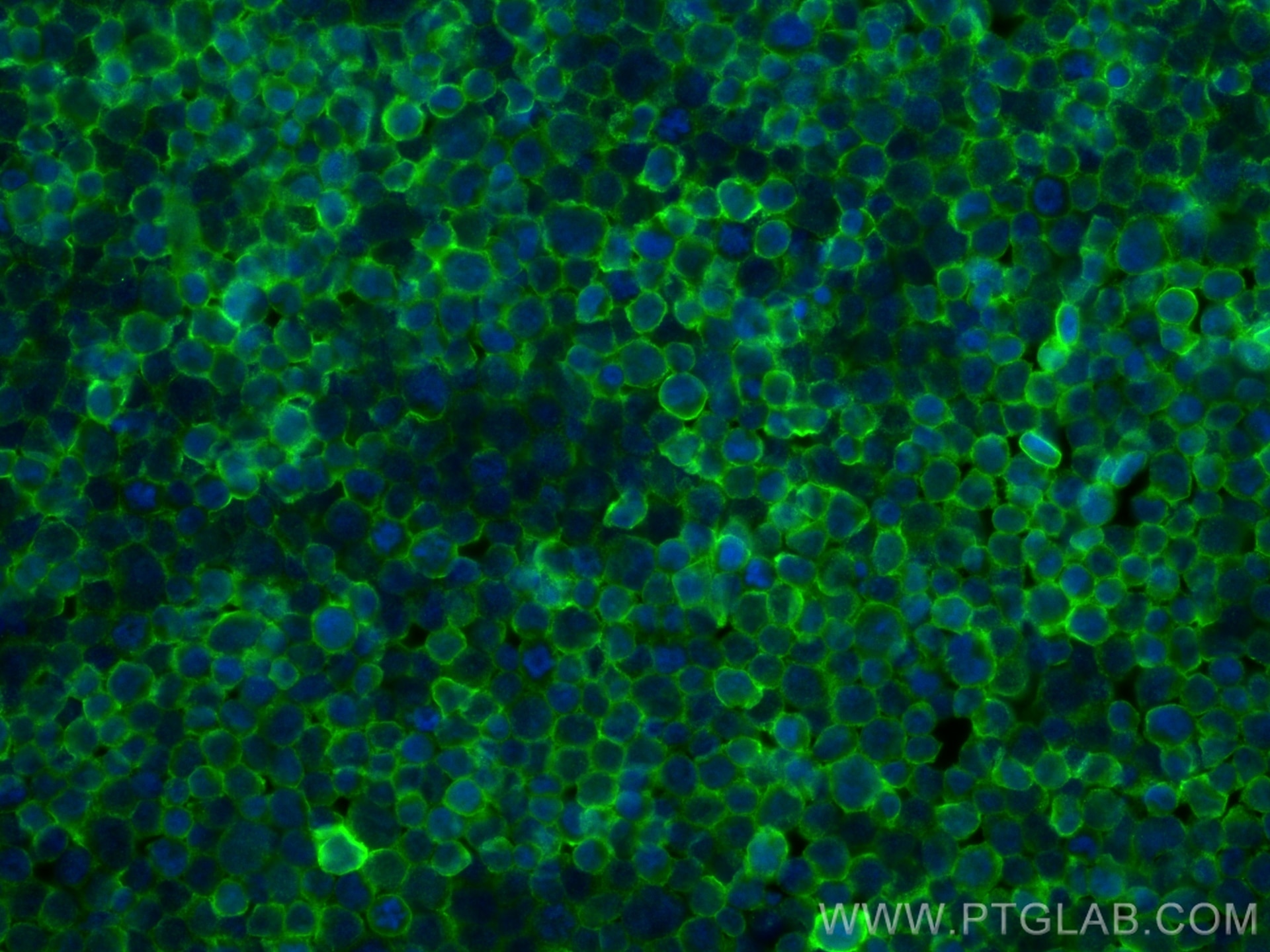 Immunofluorescence (IF) / fluorescent staining of Jurkat cells using CD47 Monoclonal antibody (60551-1-Ig)