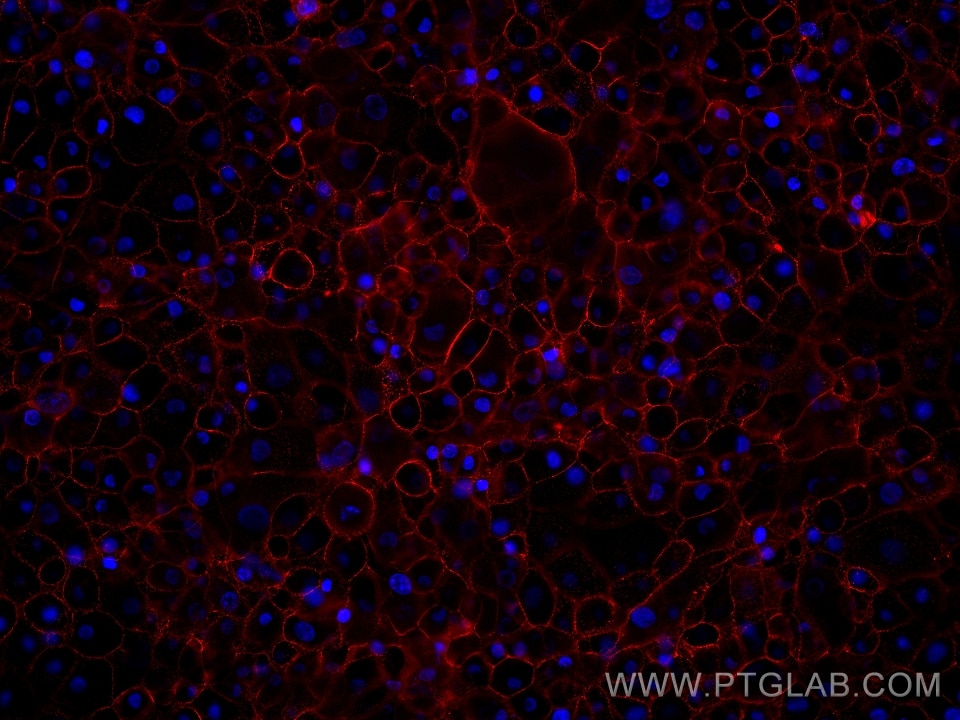 Immunofluorescence (IF) / fluorescent staining of A431 cells using CD47 Monoclonal antibody (60551-1-Ig)
