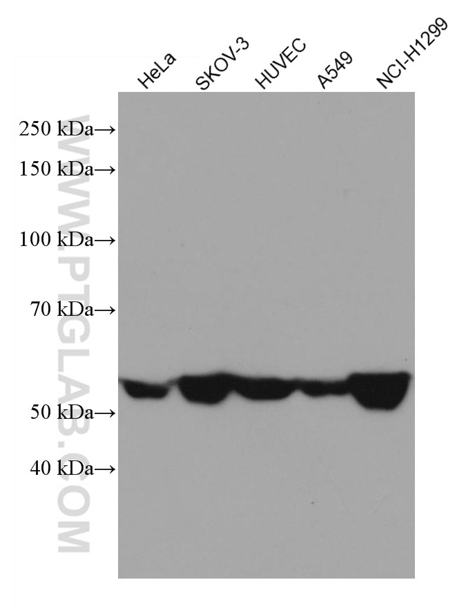 Western Blot (WB) analysis of various lysates using CD47 Monoclonal antibody (66304-1-Ig)