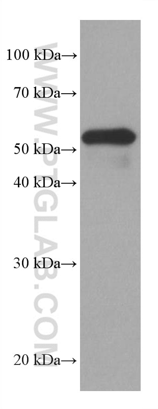 WB analysis of human placenta using 66304-1-Ig