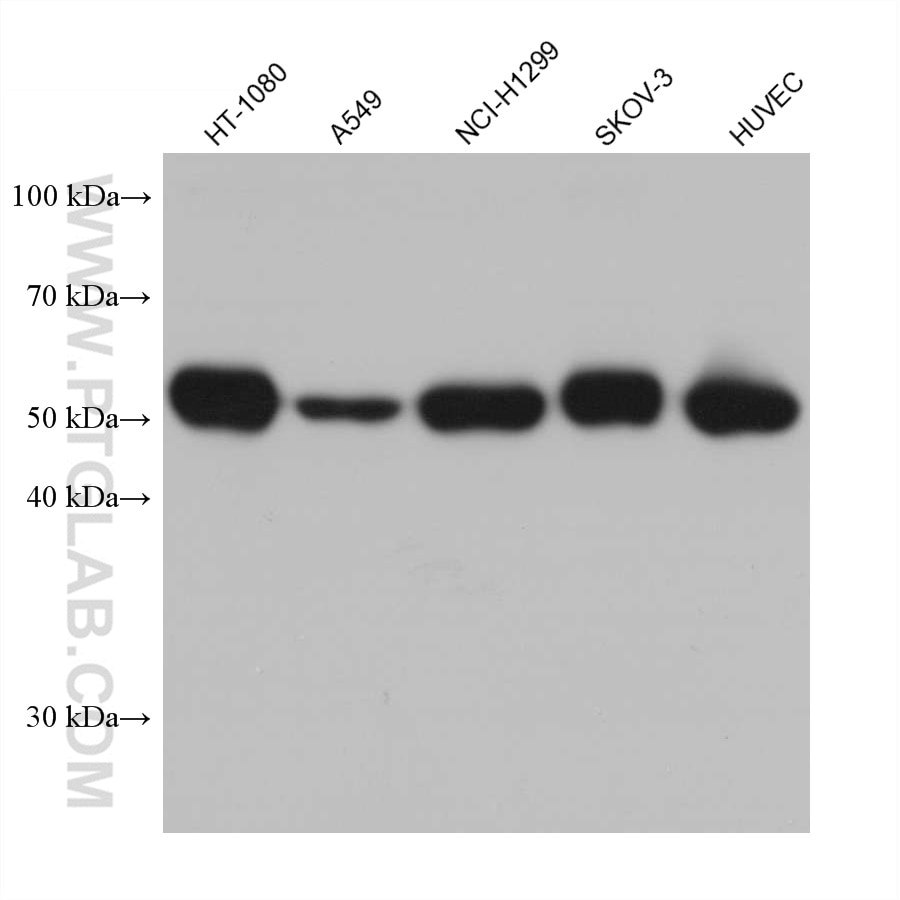 Western Blot (WB) analysis of various lysates using CD47 Monoclonal antibody (66304-1-Ig)