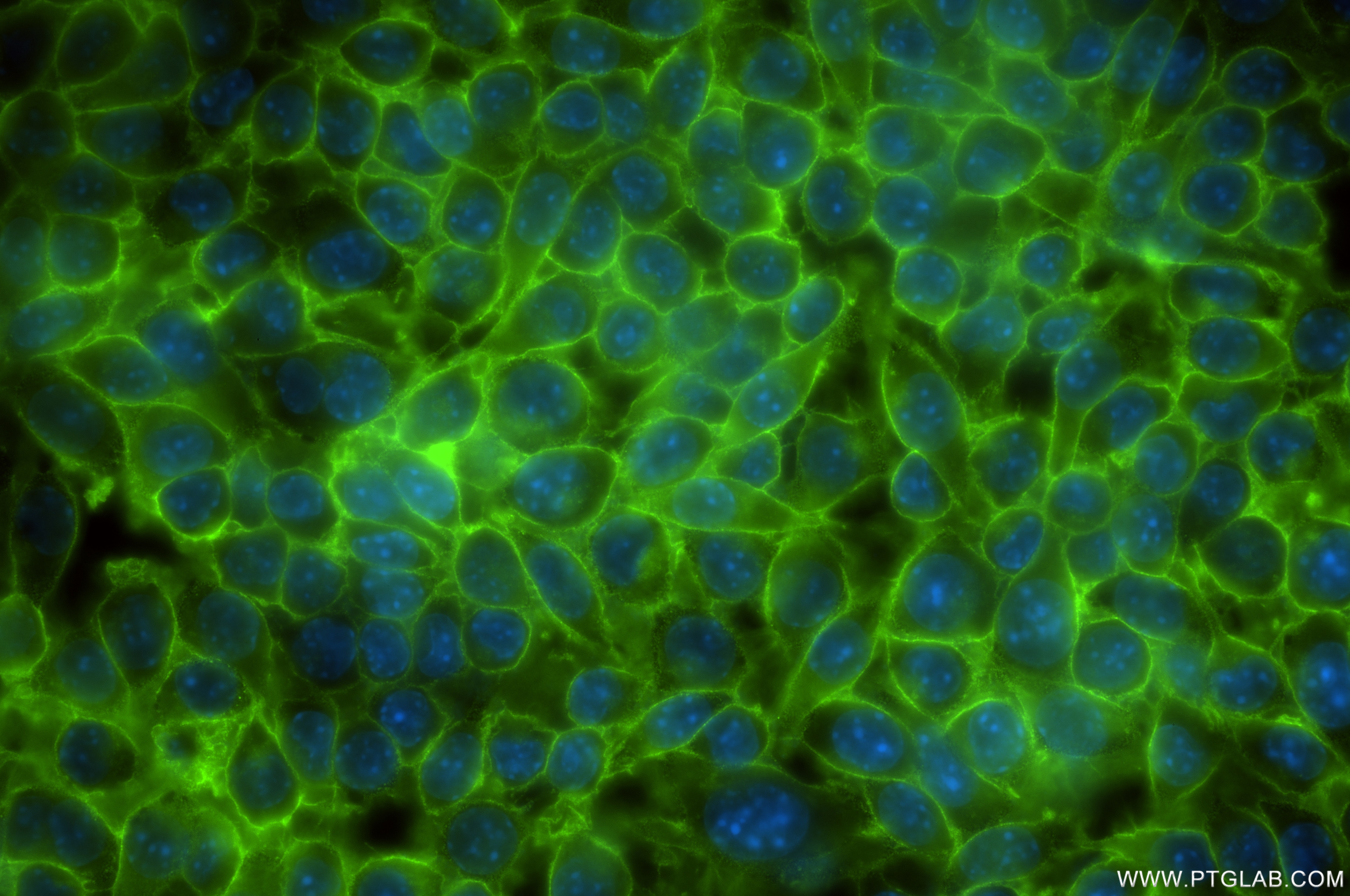 Immunofluorescence (IF) / fluorescent staining of RAW 264.7 cells using CD47 Recombinant antibody (85958-1-RR)