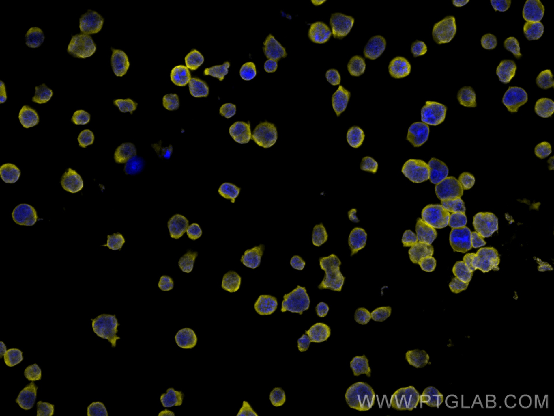 Immunofluorescence (IF) / fluorescent staining of Jurkat cells using CoraLite®532-conjugated CD47 Monoclonal antibody (CL532-66304)