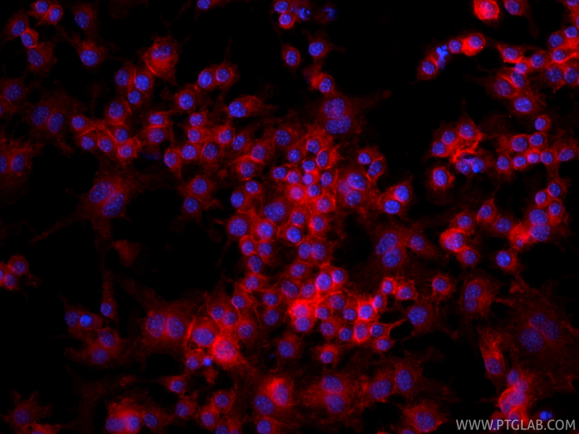Immunofluorescence (IF) / fluorescent staining of RAW 264.7 cells using CoraLite®594-conjugated CD47 Recombinant monoclona (CL594-85958)