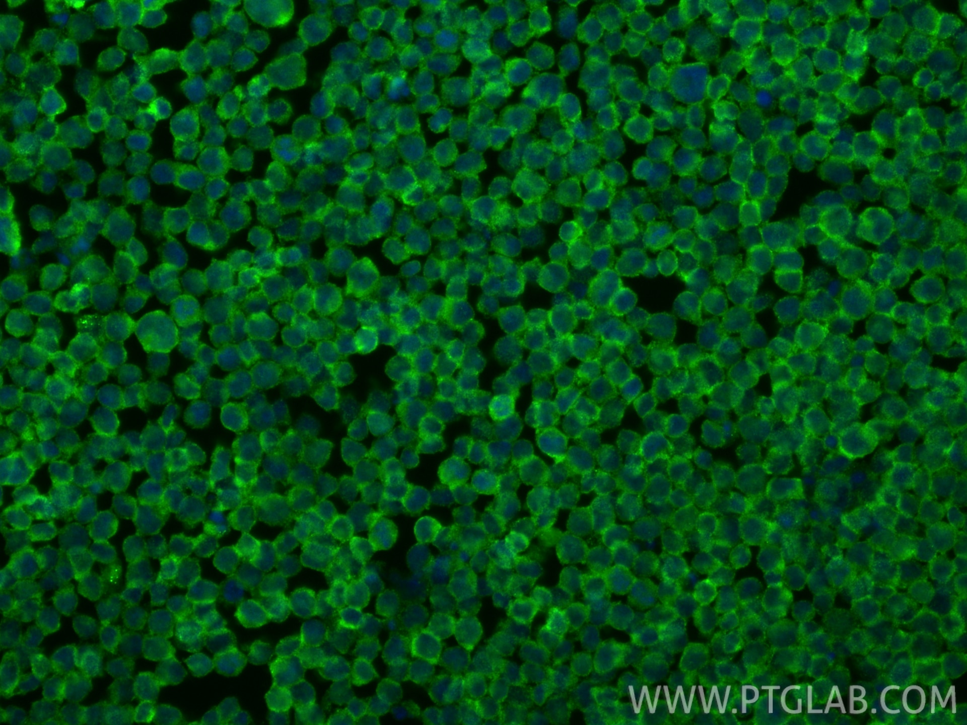 Immunofluorescence (IF) / fluorescent staining of Jurkat cells using CD48 Polyclonal antibody (27519-1-AP)