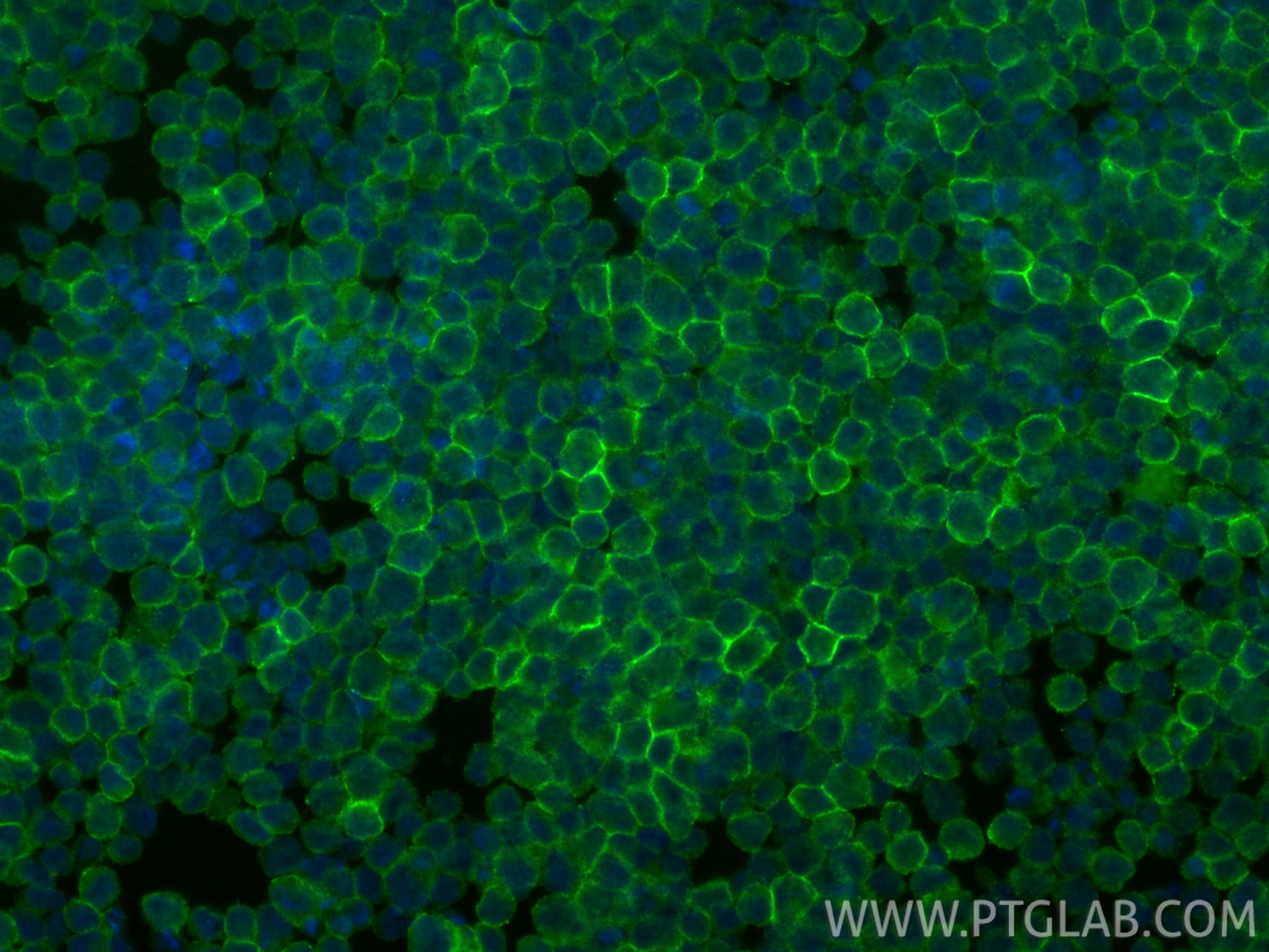 Immunofluorescence (IF) / fluorescent staining of Ramos cells using CD48 Polyclonal antibody (27519-1-AP)