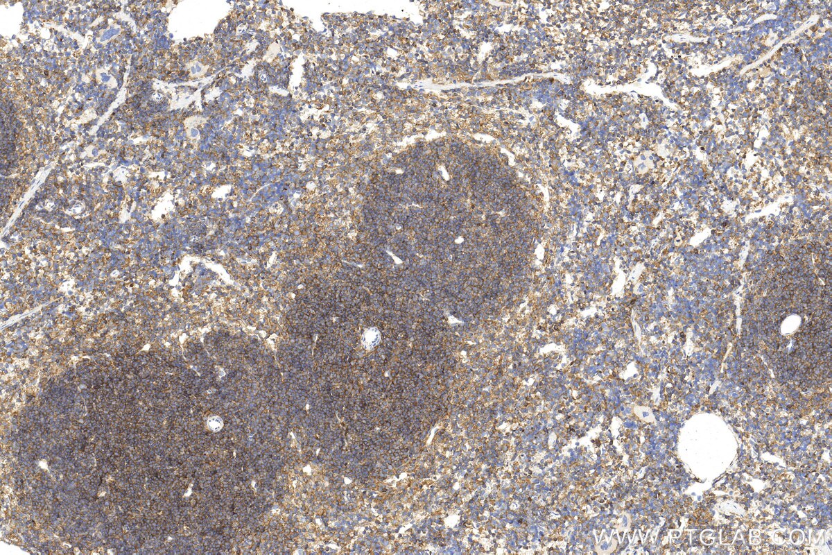 Immunohistochemistry (IHC) staining of mouse spleen tissue using CD48 Polyclonal antibody (31774-1-AP)