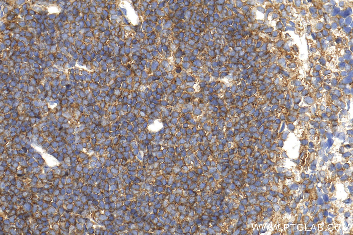Immunohistochemistry (IHC) staining of mouse spleen tissue using CD48 Polyclonal antibody (31774-1-AP)