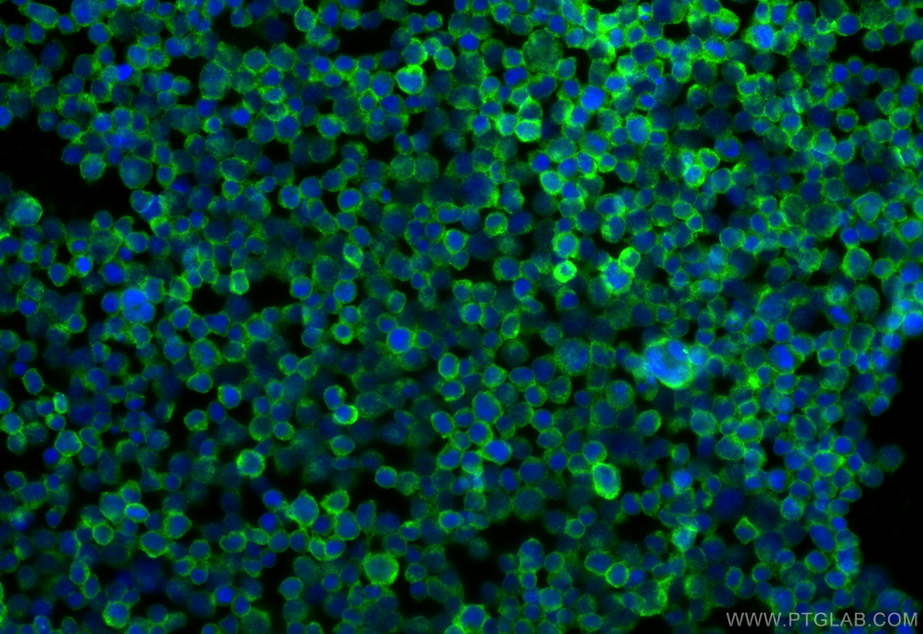 Immunofluorescence (IF) / fluorescent staining of Jurkat cells using CD48 Polyclonal antibody (31945-1-AP)