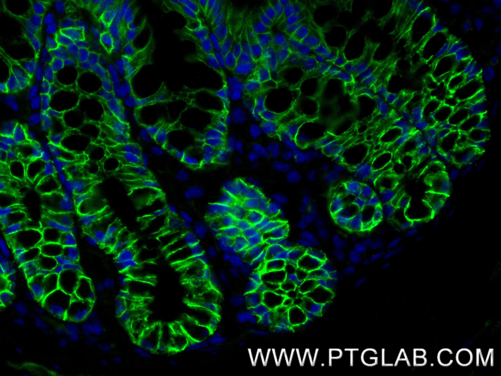 IF Staining of mouse colon using 87503-1-RR Immunofluorescence (IF) / fluorescent staining of mouse colon tissue using CD49b Recombinant monoclonal antibody (87503-1-RR)