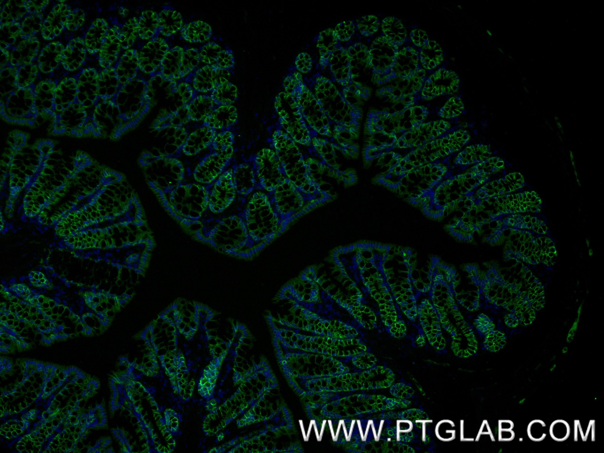 IF Staining of mouse colon using 87503-1-RR Immunofluorescence (IF) / fluorescent staining of mouse colon tissue using CD49b Recombinant monoclonal antibody (87503-1-RR)