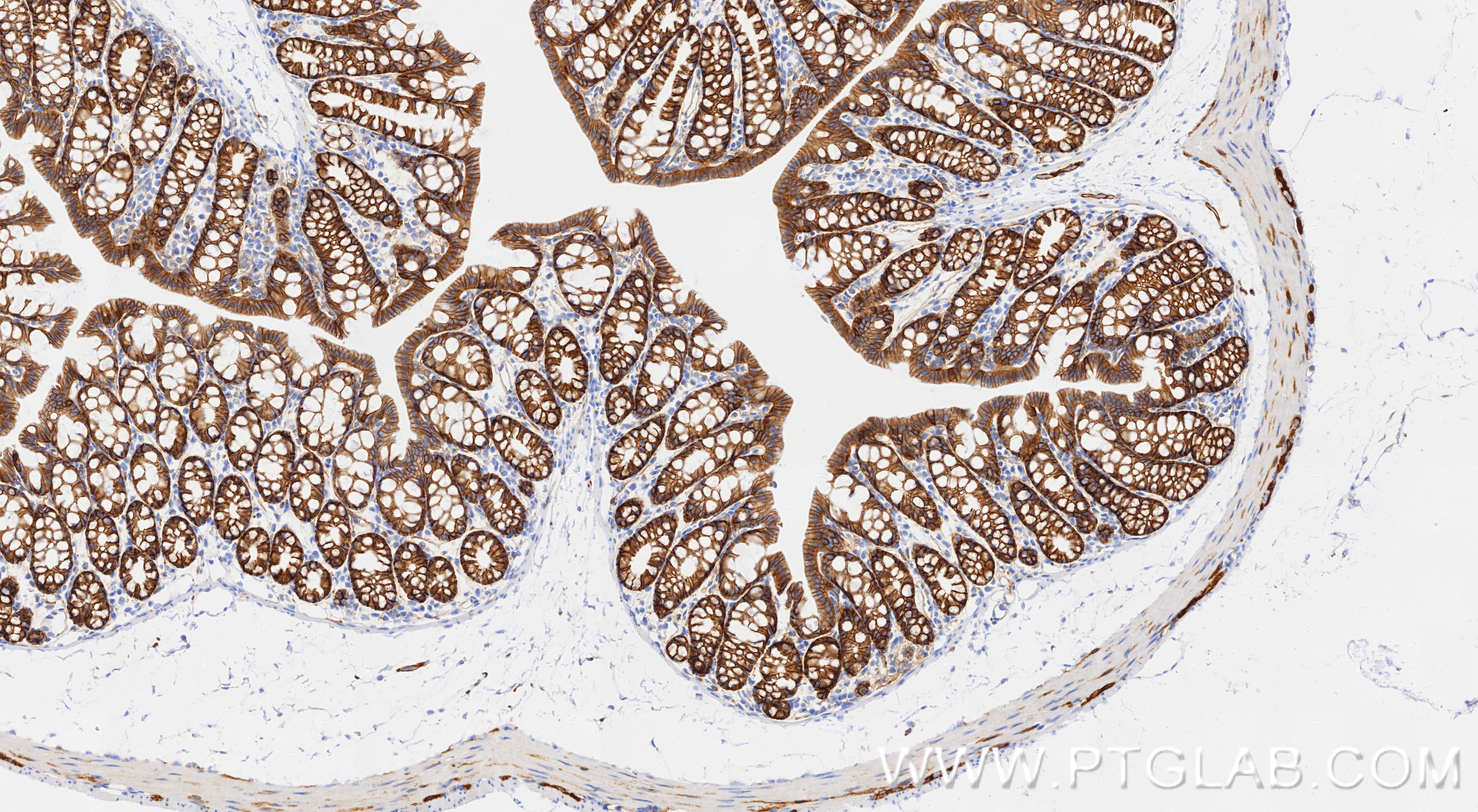 IHC staining of mouse colon using 87503-1-RR Immunohistochemistry (IHC) staining of mouse colon tissue using CD49b Recombinant monoclonal antibody (87503-1-RR)