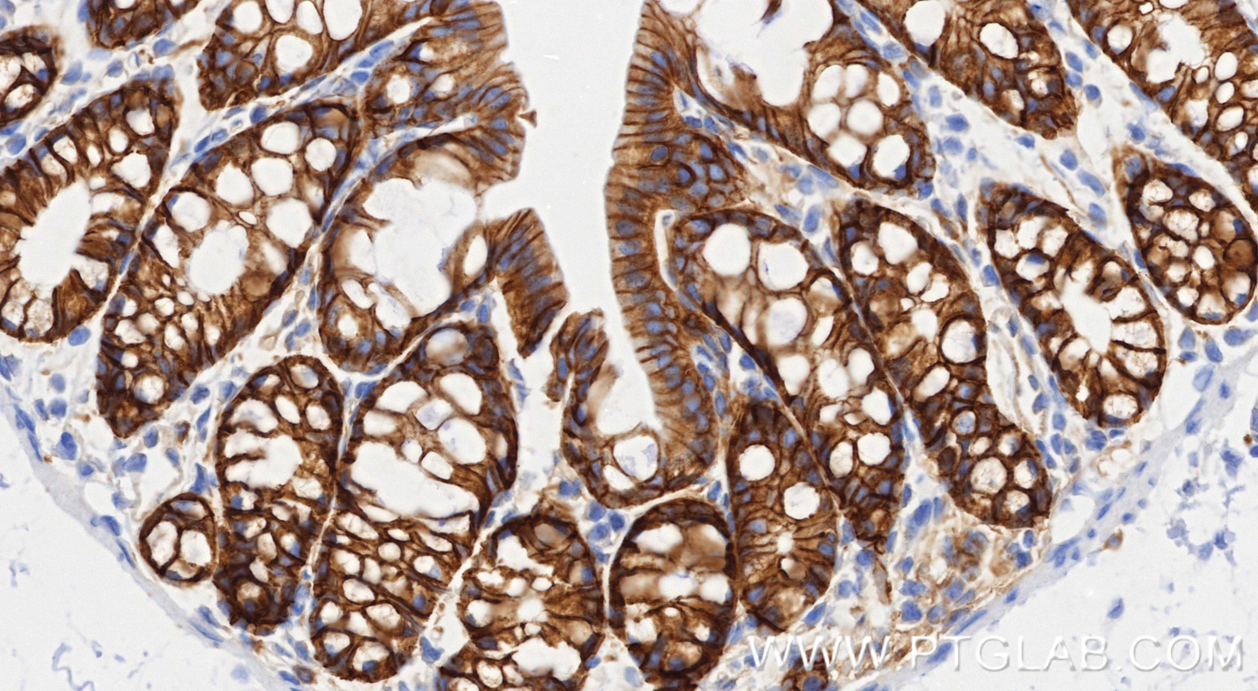 IHC staining of mouse colon using 87503-1-RR Immunohistochemistry (IHC) staining of mouse colon tissue using CD49b Recombinant monoclonal antibody (87503-1-RR)