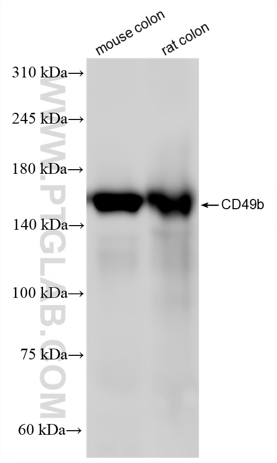 WB analysis using 87503-1-RR Western Blot (WB) analysis of various lysates using CD49b Recombinant monoclonal antibody (87503-1-RR)